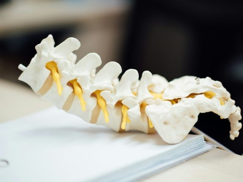Anatomisk modell av ländryggens kotor med gula nervrötter på ett bord