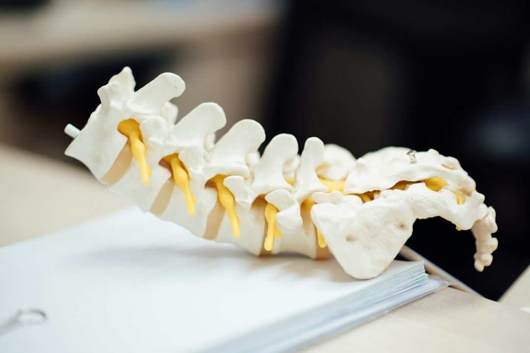 Anatomisk modell av ländryggens kotor med gula nervrötter på ett bord